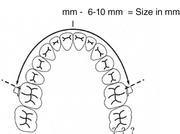 Photographie orthodontique dentaire miroirs unilatéraux miroir de  photographie dentaire en acier inoxydable