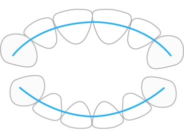 ProTain™ contention digitale, mâchoire supérieure & inférieure