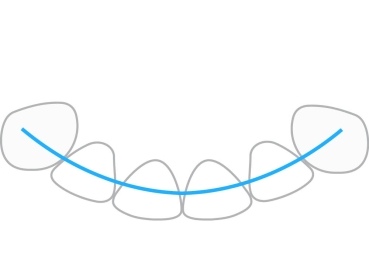 ProTain™ contention digitale, mâchoire inférieure