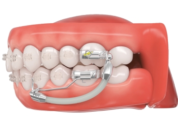 Flex Developer™ 2.0, pièce de fermeture droite