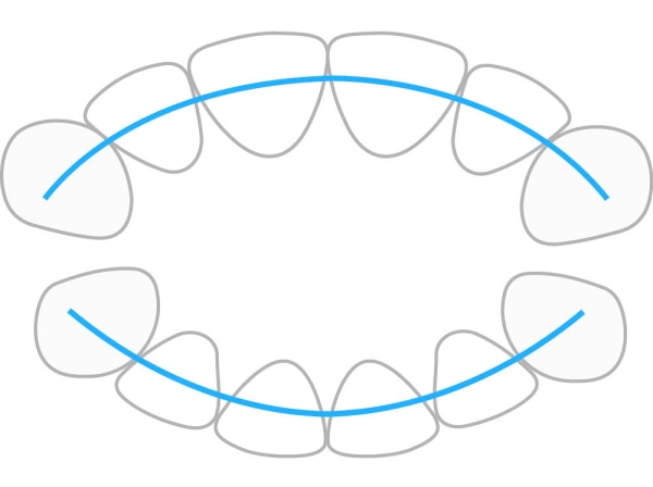 ProTain™ contention digitale, mâchoire supérieure & inférieure