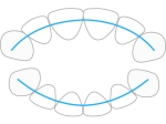 ProTain™ contention digitale, mâchoire supérieure & inférieure